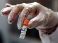 Получившие экспериментальный препарат от вируса Эбола американцы выздоровели.