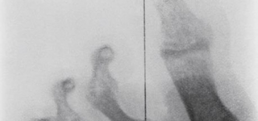 Самые причудливые рентгеновские снимки в истории медицины. Некоторые из них жуткие и пугающие, возможно часть из них вызовет у вас шок. Трудно поверить в то, что это правда, однако снимки говорят сами за себя.