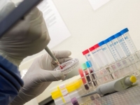 Вакцина против Эболы успешно испытана на макаках