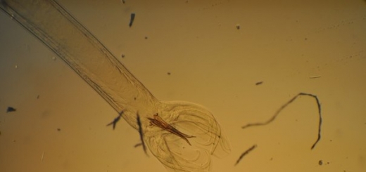 Ученые: черви-паразиты выбирают свою жертву по запаху